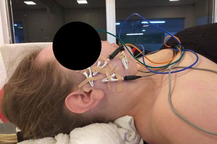 Studio Cibele Barcelos - Eletroneedling (Agulhamento com eletrodos)